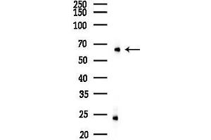 anti-SLU7 Splicing Factor Homolog (SLU7) (Internal Region) antibody