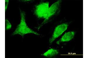 Immunofluorescence of monoclonal antibody to TNFSF6 on HeLa cell. (FASL Antikörper  (AA 1-281))