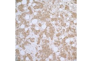 Immunohistochemistry (IHC) image for anti-Heat Shock 27kDa Protein 1 (HSPB1) (AA 150-200) antibody (ABIN7453910) (HSP27 Antikörper  (AA 150-200))