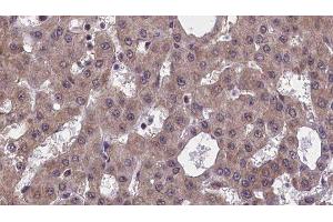 Immunohistochemistry (IHC) image for anti-Adaptor-Related Protein Complex 2, alpha 2 Subunit (AP2A2) (Internal Region) antibody (ABIN6259963)