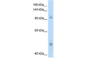 Western Blotting (WB) image for anti-Nuclear Factor of kappa Light Polypeptide Gene Enhancer in B-Cells 1 (NFKB1) (N-Term) antibody (ABIN2780565)