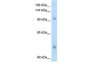 WB Suggested Anti-NFKB1 Antibody Titration:  0. (NFKB1 Antikörper  (N-Term))