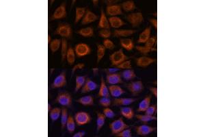 Immunofluorescence analysis of L929 cells using TRIM16 antibody (ABIN7270978) at dilution of 1:100. (TRIM16 Antikörper  (AA 1-210))