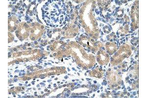 Image no. 1 for anti-Hypoxia Inducible Factor 3, alpha Subunit (HIF3A) (C-Term) antibody (ABIN203237) (HIF3A Antikörper  (C-Term))