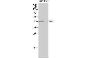 Western Blotting (WB) image for anti-Dual Specificity Phosphatase 4 (DUSP4) (Internal Region) antibody (ABIN3176026) (DUSP4 Antikörper  (Internal Region))