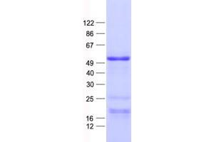 Validation with Western Blot