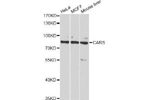Western blot analysis of extracts of various cell lines, using CARS antibody (ABIN2561571) at 1:1000 dilution. (CARS Antikörper)