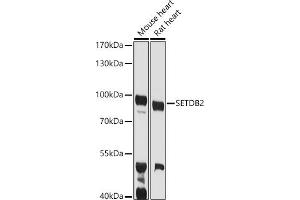 Western blot analysis of extracts of various cell lines, using SETDB2 antibody (ABIN6131576, ABIN6147657, ABIN6147658 and ABIN6223256) at 1:1000 dilution. (SETDB2 Antikörper  (AA 1-280))