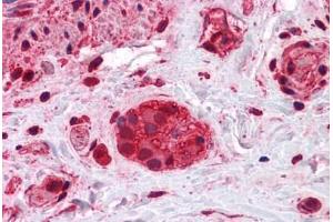 Human Colon, myenteric plexus: Formalin-Fixed, Paraffin-Embedded (FFPE) (SHC1 Antikörper  (AA 171-280))