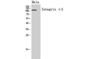 Western Blotting (WB) image for anti-Integrin, alpha 5 (ITGA5) (Internal Region) antibody (ABIN3188019) (ITGA5 Antikörper  (Internal Region))