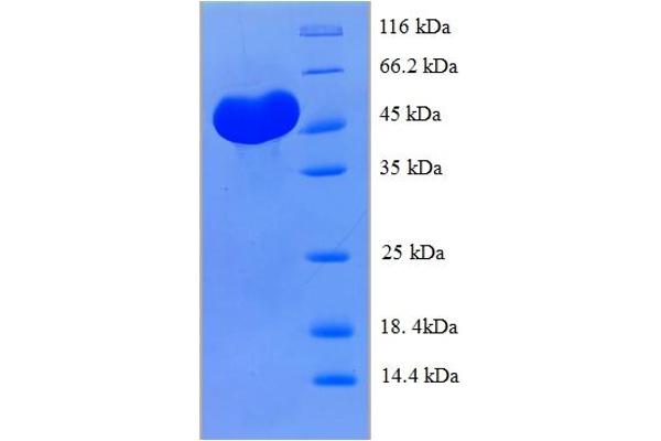 CLEC18A Protein (AA 27-446) (His-SUMO Tag)