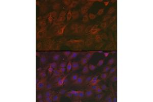 Immunofluorescence (IF) image for anti-Superoxide Dismutase 2, Mitochondrial (SOD2) (AA 25-222) antibody (ABIN3021904)