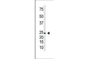 Antibody is used in Western blot to detect IL29 in Jurkat cell lysate. (IL29 Antikörper  (AA 54-85))