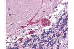 IHC Information: Paraffin embedded brain, cerebellum tissue, tested with an antibody dilution of 5 ug/ml.