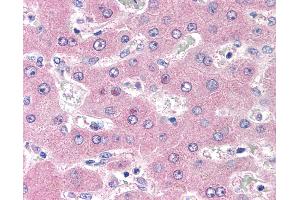 Anti-CD98 antibody IHC of human liver. (SLC3A2 Antikörper)