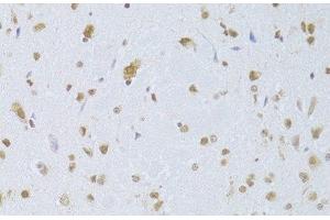Immunohistochemistry of paraffin-embedded Mouse brain using CDKN1A Polyclonal Antibody at dilution of 1:100 (40x lens). (p21 Antikörper)