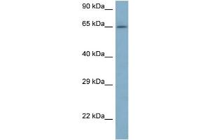 WB Suggested Anti-ARFGAP3 Antibody Titration: 1. (ARFGAP3 Antikörper  (N-Term))