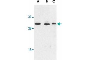 Western blot analysis of RYBP expression in human A-549 (lane A), HepG2 (lane B), and mouse NIH/3T3 (lane C) cell lysates with RYBP polyclonal antibody  at 1 ug /mL . (RYBP Antikörper  (AA 215-228))
