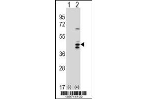 Western blot analysis of RCL1 using rabbit polyclonal RCL1 Antibody using 293 cell lysates (2 ug/lane) either nontransfected (Lane 1) or transiently transfected (Lane 2) with the RCL1 gene. (RCL1 Antikörper  (N-Term))