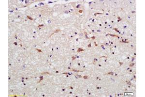 Formalin-fixed and paraffin embedded rat brain labeled with Rabbit Anti OPA1 Polyclonal Antibody, Unconjugated (ABIN1387244) at 1:200 followed by conjugation to the secondary antibody and DAB staining (OPA1 Antikörper  (AA 651-750))