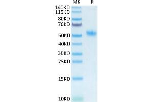 Mouse SPP1 on Tris-Bis PAGE under reduced condition. (Osteopontin Protein (AA 17-294) (His tag))