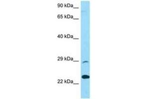 PRSS58 antibody  (AA 122-171)