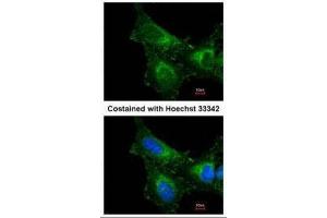 ICC/IF Image Immunofluorescence analysis of methanol-fixed HeLa, using PRX I, antibody at 1:200 dilution. (Peroxiredoxin 1 Antikörper)