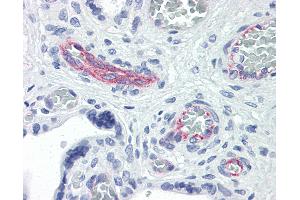 Anti-RND3 antibody IHC of human placenta. (RND3 Antikörper  (AA 1-245))