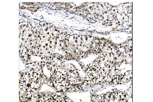 IHC analysis of EHMT2/G9A using anti-EHMT2/G9A antibody (ABIN7602084). (EHMT2 Antikörper  (AA 580-1195))