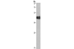 Western Blotting (WB) image for anti-Calumenin (CALU) antibody (ABIN2429669) (CALU Antikörper)
