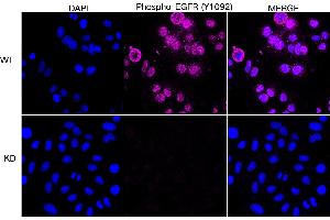 Immunocytochemical staining of HepG2 cells using Phospho-EGFR (Y) antibody (ABIN7798468), 1:1,000), Top panel: wild-type (WT), Bottom panal: Phospho-EGFR (Y) shRNA knockdown (KD). (Rekombinanter EGFR Antikörper  (pTyr1068))