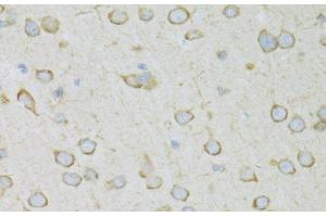 Immunohistochemistry of paraffin-embedded Rat brain using RPL13 Polyclonal Antibody at dilution of 1:100 (40x lens).