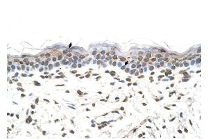 FTCD antibody was used for immunohistochemistry at a concentration of 4-8 ug/ml to stain Squamous epithelial cells (arrows) in Human Skin.