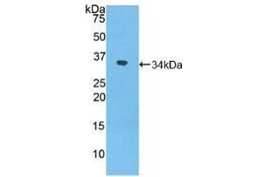 Detection of Recombinant NXN, Mouse using Polyclonal Antibody to Nucleoredoxin (NXN) (NXN Antikörper  (AA 167-435))