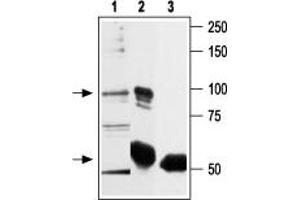 Immunoprecipitation of rat basophilic leukemia (RBL) lysate: - 1. (TRPV2 Antikörper  (C-Term, Intracellular))
