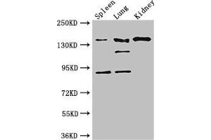Western Blot Positive WB detected in: Mouse spleen tissue, Mouse lung tissue, Mouse kidney tissue All lanes: NOS1 antibody at 3 μg/mL Secondary Goat polyclonal to rabbit IgG at 1/50000 dilution Predicted band size: 161, 149, 126, 44, 165 kDa Observed band size: 161, 126, 92 kDa