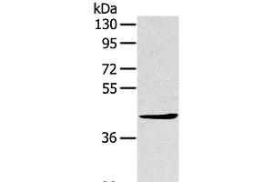 Western Blot analysis of A431 cell using TNIP2 Polyclonal Antibody at dilution of 1:500 (TNIP2 Antikörper)