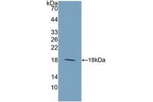 Detection of Recombinant IL9, Human using Polyclonal Antibody to Interleukin 9 (IL9) (IL-9 Antikörper  (AA 19-144))