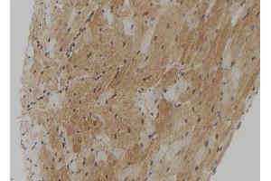 ABIN6272881 at 1/100 staining Mouse heart tissue by IHC-P.