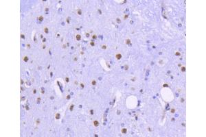 Immunohistochemistry (Paraffin-embedded Sections) (IHC (p)) image for anti-Histone Deacetylase 2 (HDAC2) antibody (ABIN5557480)