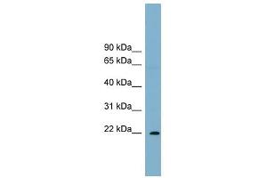 PCNP antibody used at 1 ug/ml to detect target protein. (PCNP Antikörper  (Middle Region))