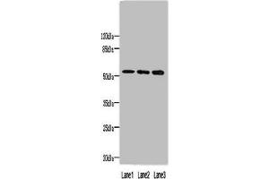 Western blot All lanes: MINDY1 antibody at 8 μg/mL Lane 1: Mouse liver tissue Lane 2: A549 whole cell lysate Lane 3: HepG2 whole cell lysate Secondary Goat polyclonal to rabbit IgG at 1/10000 dilution Predicted band size: 52, 37, 57, 42 kDa Observed band size: 52 kDa (Ubiquitin Carboxyl-Terminal Hydrolase MINDY-1 (MINDY1) (AA 3-278), (C-Term) Antikörper)