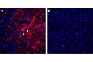 Expression of Homer1 in rat parietal cortex. (Homer Homolog 1 (HOMER1) Peptid)