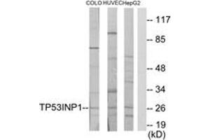 Western blot analysis of extracts from COLO205/HuvEc/HepG2 cells, using TP53INP1 Antibody. (TP53INP1 Antikörper  (AA 171-220))