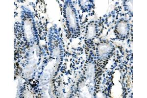 IHC analysis of IRF1 using anti-IRF1 antibody (ABIN7600281). (IRF1 Antikörper  (AA 170-315))