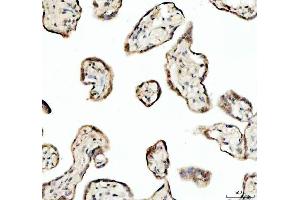 IHC analysis of SP6 using anti-SP6 antibody (ABIN5692945).