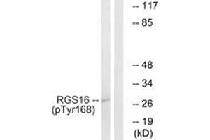 Western blot analysis of extracts from COS7 cells treated with heat shock, using RGS16 (Phospho-Tyr168) Antibody. (RGS16 Antikörper  (pTyr168))