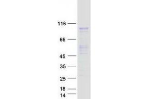 Validation with Western Blot (PRMT10 Protein (Myc-DYKDDDDK Tag))