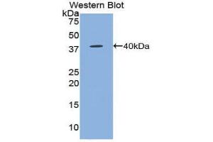 Western Blotting (WB) image for anti-Chemokine (C-C Motif) Ligand 5 (CCL5) (AA 24-91) antibody (ABIN3209288) (CCL5 Antikörper  (AA 24-91))