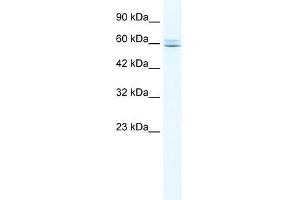 Western Blotting (WB) image for anti-Core-binding Factor, Runt Domain, alpha Subunit 2, Translocated To, 3 (CBFA2T3) (N-Term) antibody (ABIN1105706)